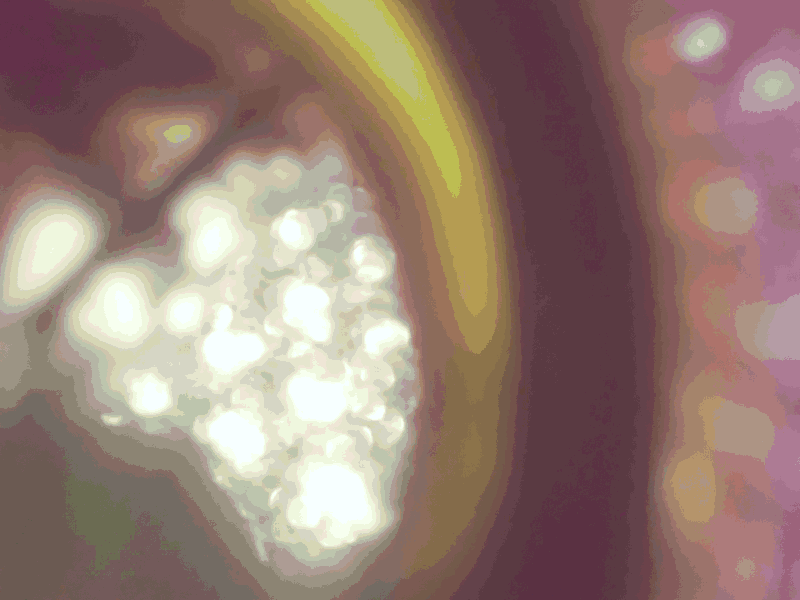 The blurry image exhibiting severe 64-color quantization error